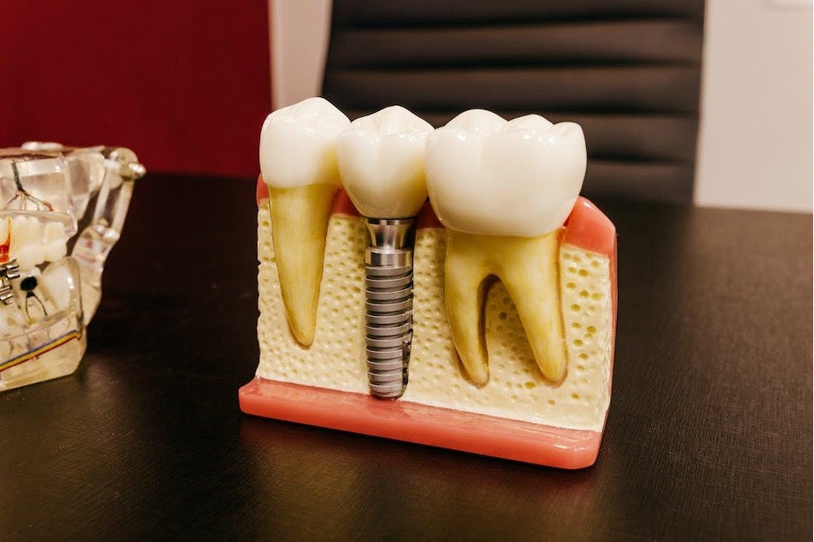 How a Dental Implant Specialist Can Transform Your Smile This Year