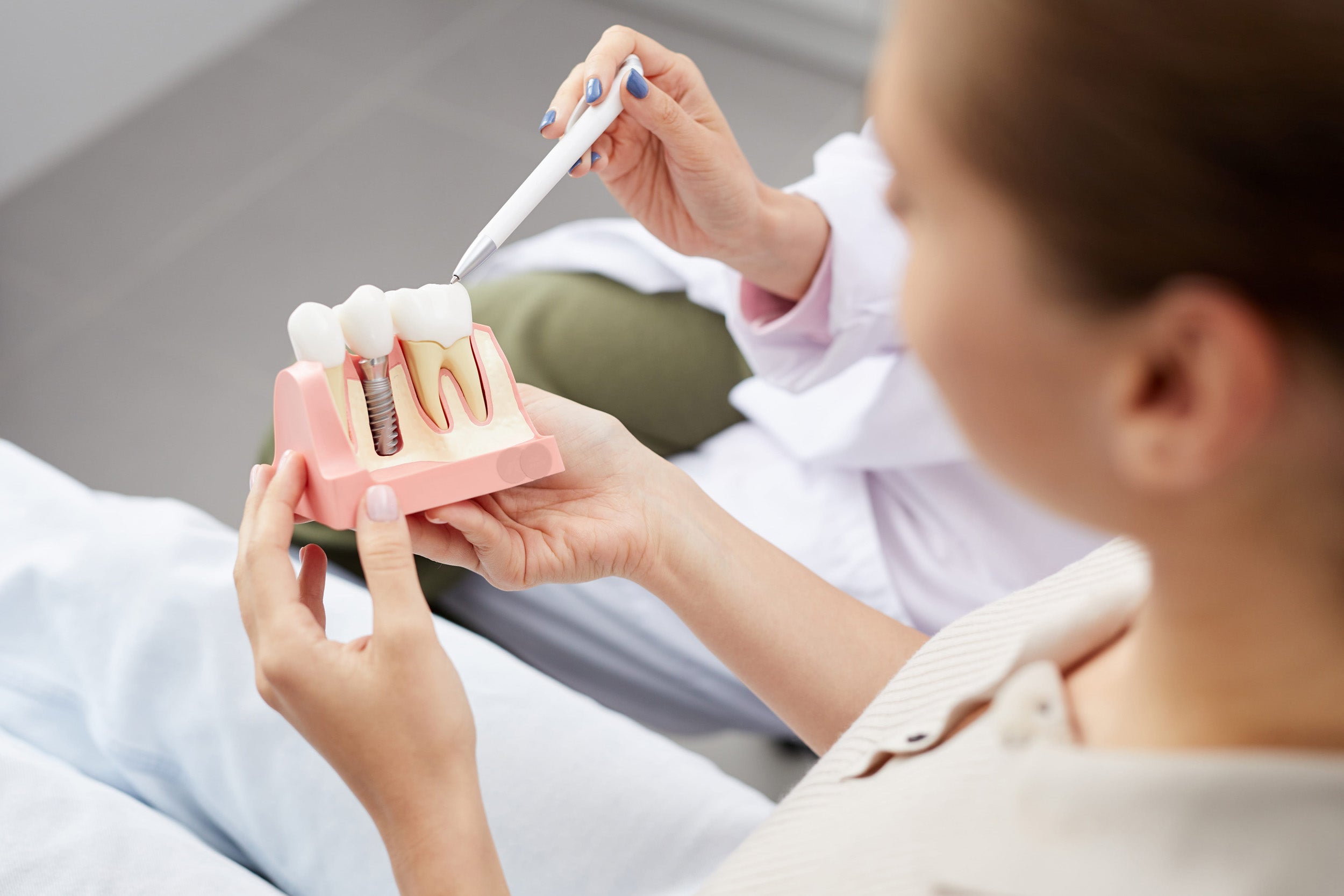 Dental Implant Surgery: A Complete Overview for Potential Patients