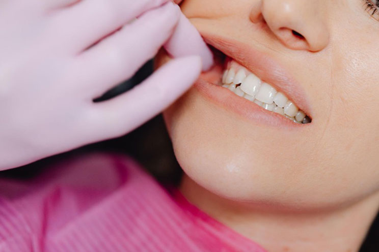 5 Reasons Why Invisalign Braces are Right for You