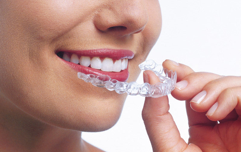 7 Concerns Regarding An Invisible Braces Fix