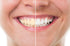 Save 50% on Zoom Teeth Whitening This Christmas