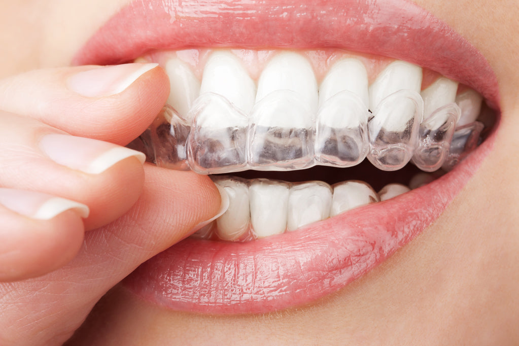 Join us for our Invisalign Open Day!