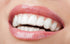 The three best types of invisible orthodontic braces