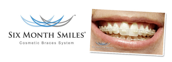 Six Month Smiles